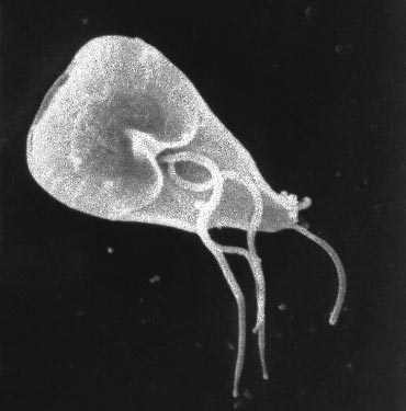 人体寄生虫 人体十大寄生虫:弓形虫会侵袭中枢神经系统(2)