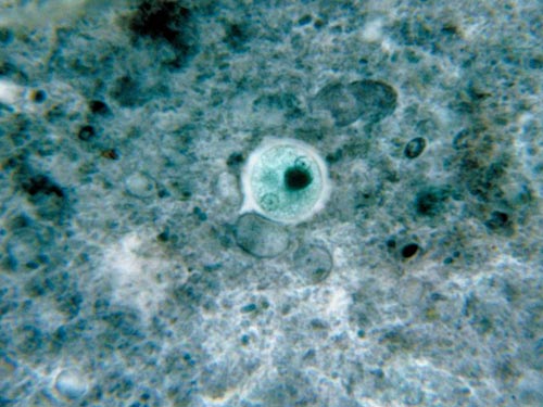 痢疾阿米巴 人体十大寄生虫:弓形虫会侵袭中枢神经系统(2)