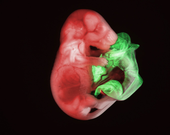 2007年最佳图片：转基因老鼠胚胎
