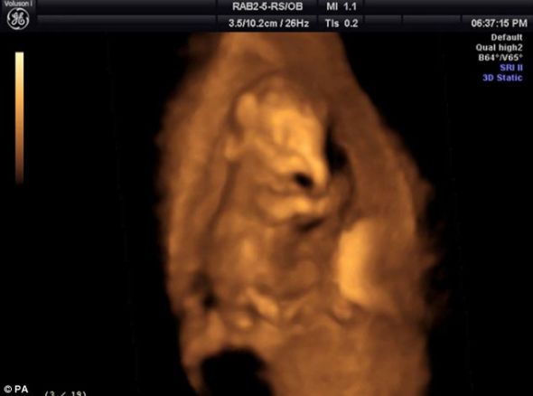大象胎儿的鼻子清晰可见！动物园工作人员对妊娠大约3个月到22个月的大象胎儿进行了超声波扫描。