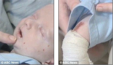 ʹ��ļ��������͵ϵĿ�ǻ����ͷ�ϳ���ˮ�ݣ�����Ҳ��Ȼ�жദ�˿�