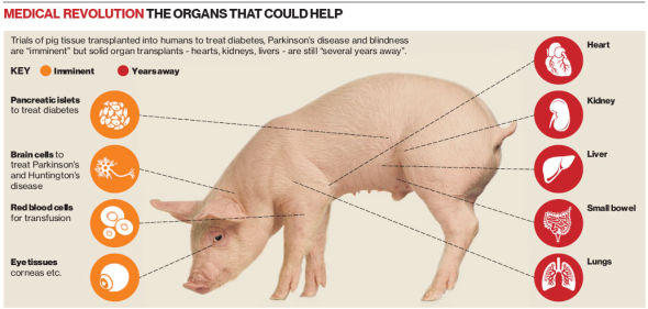 把猪组织移植给人类，用来治疗糖尿病、帕金森氏症和失明的试验“即将进行”，但是实体器官移植(心脏、肾和肝移植)仍需要“几年时间才能变成现实”