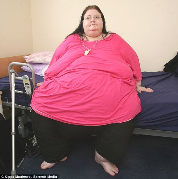 英最胖女体重254公斤 曾压断汽车架科学探索科技时代新浪网