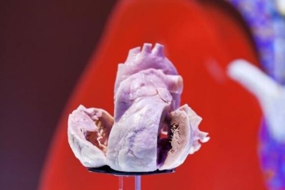 2013年9月2日欧洲心脏病学会会议上展出的一个人造人类心脏