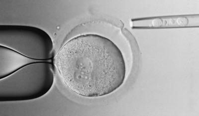 美国启动胚胎干细胞临床试验_科学探索