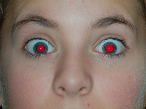 使用内置闪光灯拍照如何防止出现"红眼"