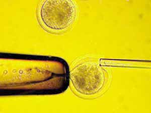 �Ƽ�ʱ��_Ӣ��׼���޻����̥�о�����޴�����(ͼ)