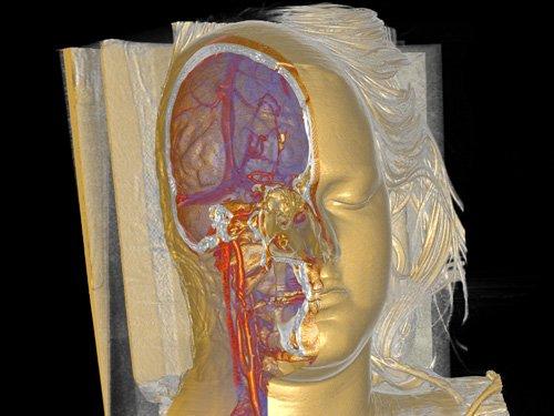 奇妙三維CT照片透視人體和動物內部奧秘圖片1