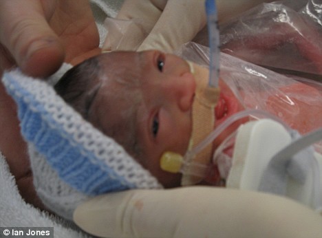 死后的珍妮剖腹产产下健康的女婴艾雅 死后的珍妮剖腹产产下健康的女婴艾雅