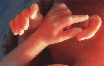 胎儿发育图谱: 17～20周时的胎儿