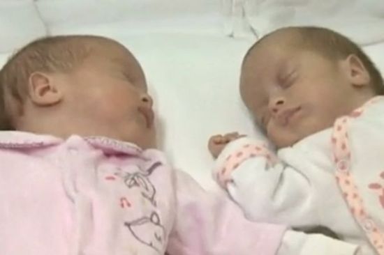 罗马尼亚双胞胎女婴出生日期相隔2月(图)_育儿