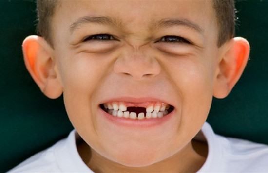 找到牙齿去医生   小伙伴们,你们觉得应该是哪个呢?