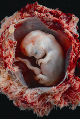 图 2-15周胚胎 图片来源@社团的微博