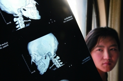 3名中国<em>女孩韩国</em>整容噩梦:变得鼻歪脸斜 维权