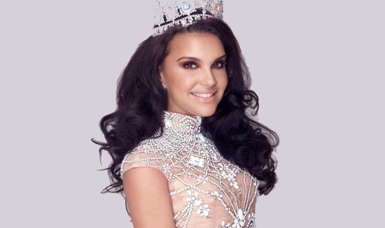 龅牙妹矫正下颌后成为选美皇后