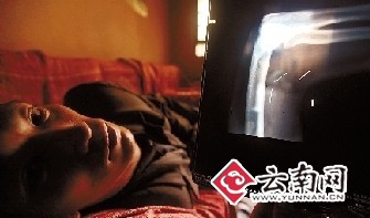 昆明又现体内“长钢针”怪事共取出15根钢针