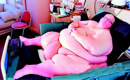 世界首胖<em>减肥</em>292公斤_新浪新闻