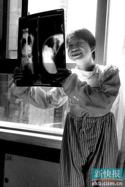 女孩腰弯十多年终圆平躺睡觉梦_新浪新闻