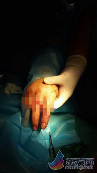  上海 第五人民医院 发生 伤医 事件   砍人 者为病患