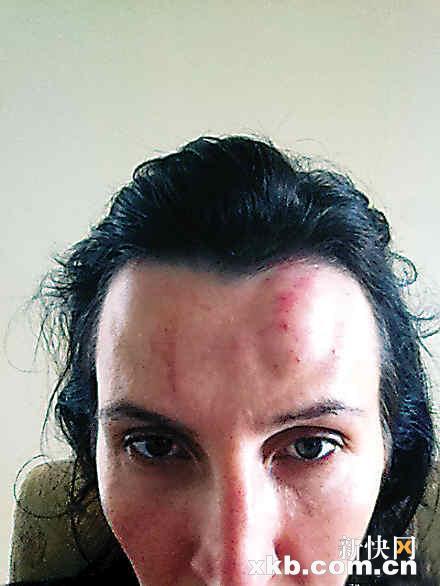 传疯狂英语李阳对美籍妻子施家暴 妻遍体鳞伤