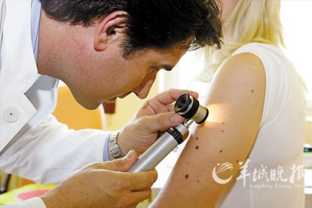 黑痣斑点常为皮肤癌信号发现后应及时筛查