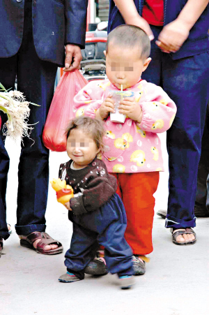 5岁女童身高54厘米疑因近亲结婚所致(图)