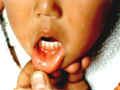 ������ڲ���ˮ�����没�����������ɷ����ص�