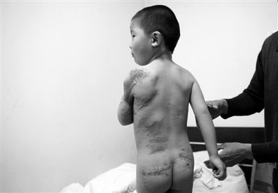 3��ͯ��3��ҧ�˽�������