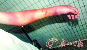 打伤少年制造假车祸这伙“撞车帮”心太黑!