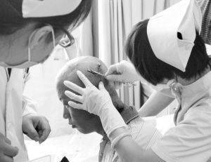 射钉枪走火 6厘米钢钉射进头