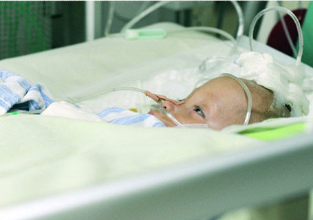 ˫��̥�ܻܵ������ԡ�ICU��40���츸ĸ��΢������