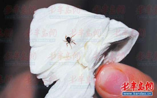 蜱虫作怪还杀不尽 夏季虫子闹民居咋防咋治