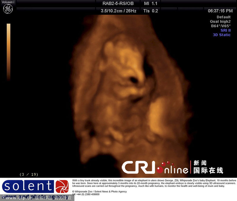3D超声波扫描展现3个月大大象宝宝可爱图像(