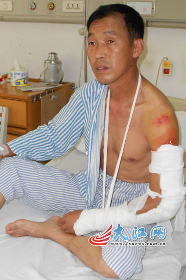 江西人广东韶关办厂遭地头蛇围殴骨折(图)