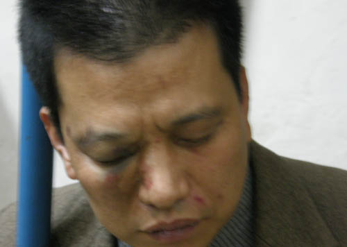 市民被刑警误抓毒打续:公安局承认误伤人