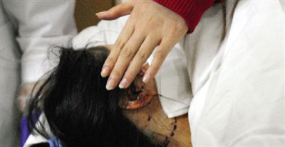 女孩因提分手遭男友用刀连划脸部致毁容(图)