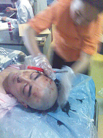 青年驾宝马撞死人后找人顶包被指车速超100码