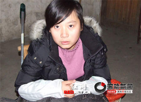 女大学生患血管瘤病血疱超8斤(图)