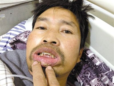 被打访民庄兴南在医院接受治疗 被打访民庄兴南在医院接受治疗