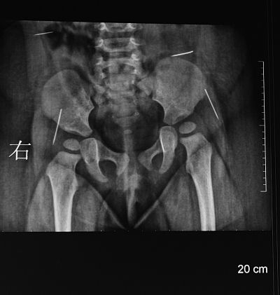 XƬ��ʾ�������������ĸ���״�����