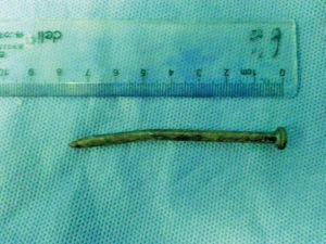 ȡ������������߰����׳���