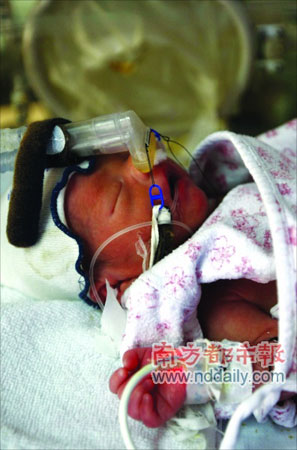 孕妇一分钟内顺产三胞胎(组图)