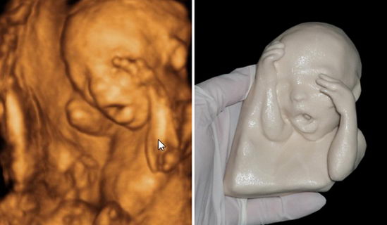 college of art)的一名博士生借助超声波等先进的技术,将胎儿的样子