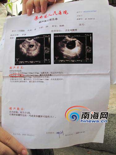 女子称堕胎后胎儿仍发育医生疑其怀双胞胎图