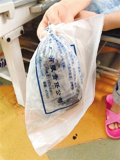 <em>7岁</em>女孩因爱吃<em>头发</em>致大半个胃被缠住(图)|异食