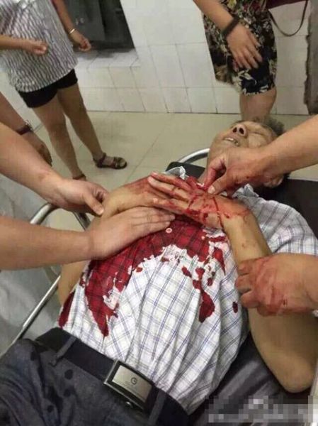 医生宋开芳被砍受伤.图片来自网络