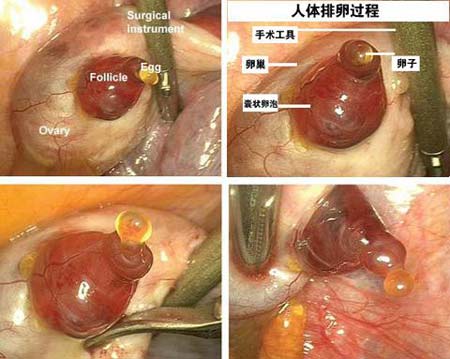 比利时妇科医生首次拍到人类排卵照片(图)