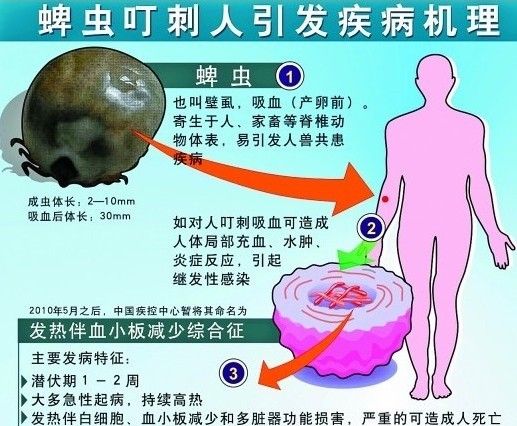 韩国现疑似蜱虫传染病 首例患者已死亡 与父赌气流浪5