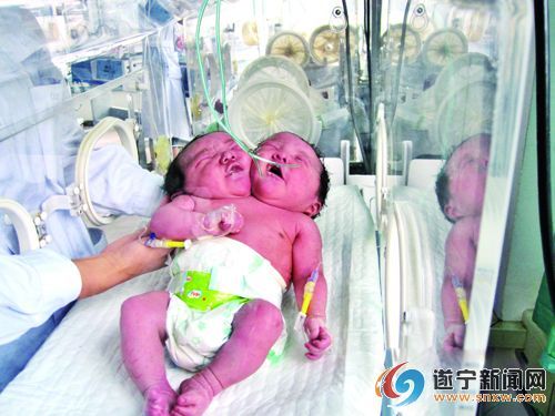 为双头女婴祈祷_太原城市广场