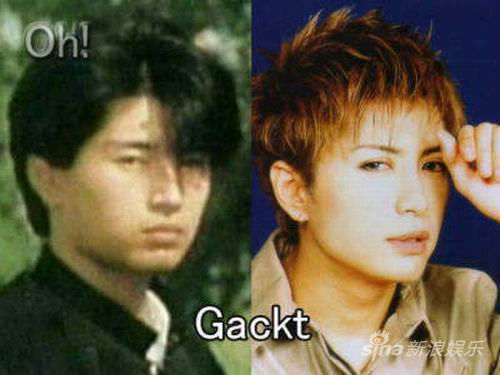 Gackt